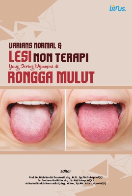 Sampul buku VARIANS NORMAL &...